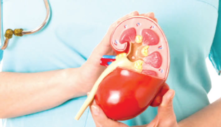 kidney failure